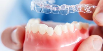 Centra Dental - Who Is a Candidate for Houston Invisalign?
