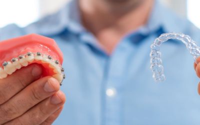Centra Dental - How to Choose the Right Type of South Houston Braces
