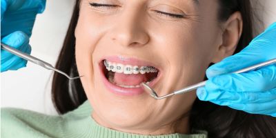 Centra Dental - Why Get Houston Braces?