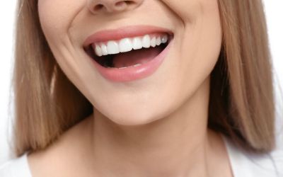 Centra Dental - Do Houston Braces Permanently Straighten Your Teeth?