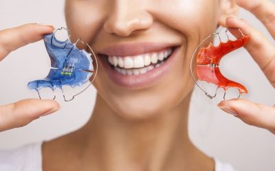 Centra Dental - Wear Your Retainers So You Can Always Smile Confidently After Houston Braces