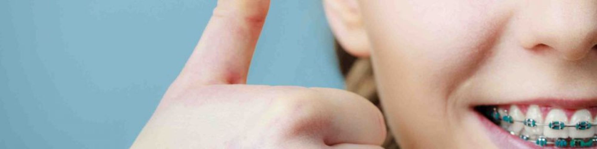 Centra Dental - Health Benefits of Braces