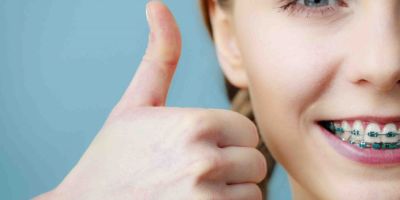Centra Dental - Health Benefits of Braces