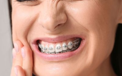 Centra Dental - What to Do About South Houston Braces Pain