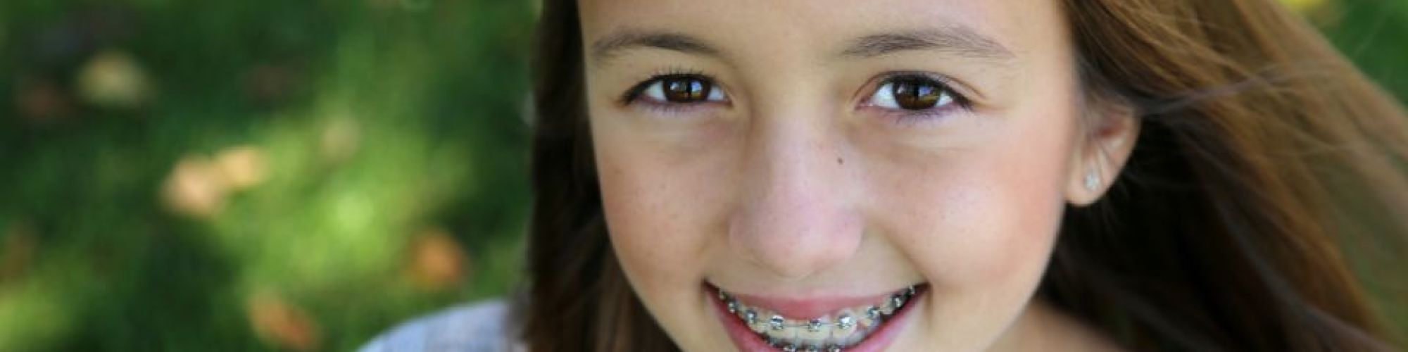 Centra Dental - Consider Early Houston Braces Treatment