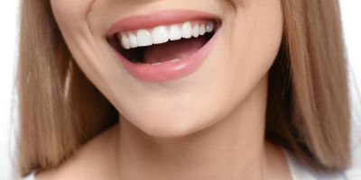 Centra Dental - Do Houston Braces Permanently Straighten Your Teeth?