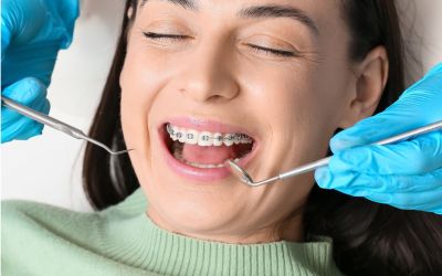 Centra Dental - Why Get Houston Braces?