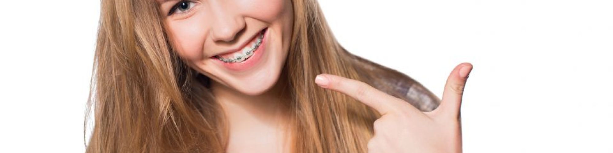 Centra Dental - Houston Braces to Correct Overbites and Underbites
