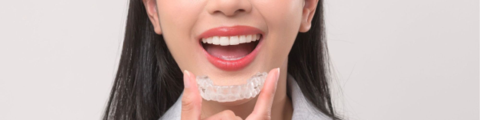 Centra Dental - Is Houston Invisalign Right for You?