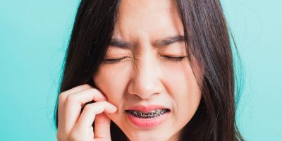 Centra Dental - Which Is Better: Ceramic Or Metal Houston Braces?