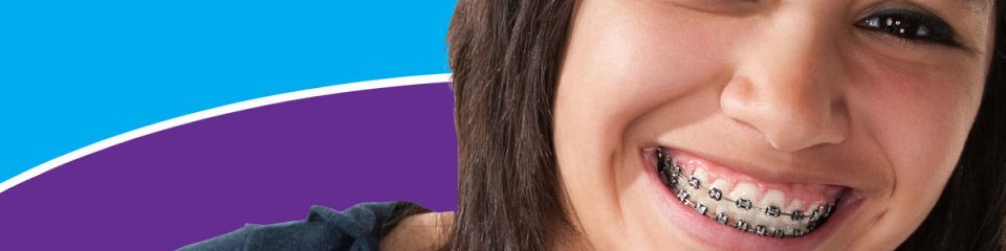 Centra Dental - Why You Should Get Braces Early