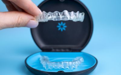 Centra Dental - Answering South Houston Invisalign FAQs