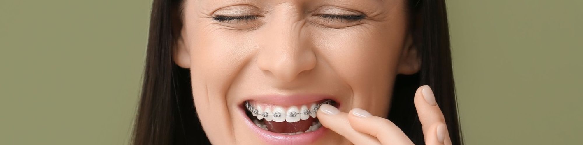 Centra Dental - How to Deal With South Houston Braces Pain