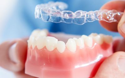 Centra Dental - Who Is a Candidate for Houston Invisalign?