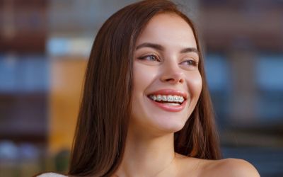 Centra Dental - Getting South Houston Braces: What to Expect the First Month