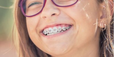 Centra Dental - Benefits of Getting Houston Braces at a Young Age