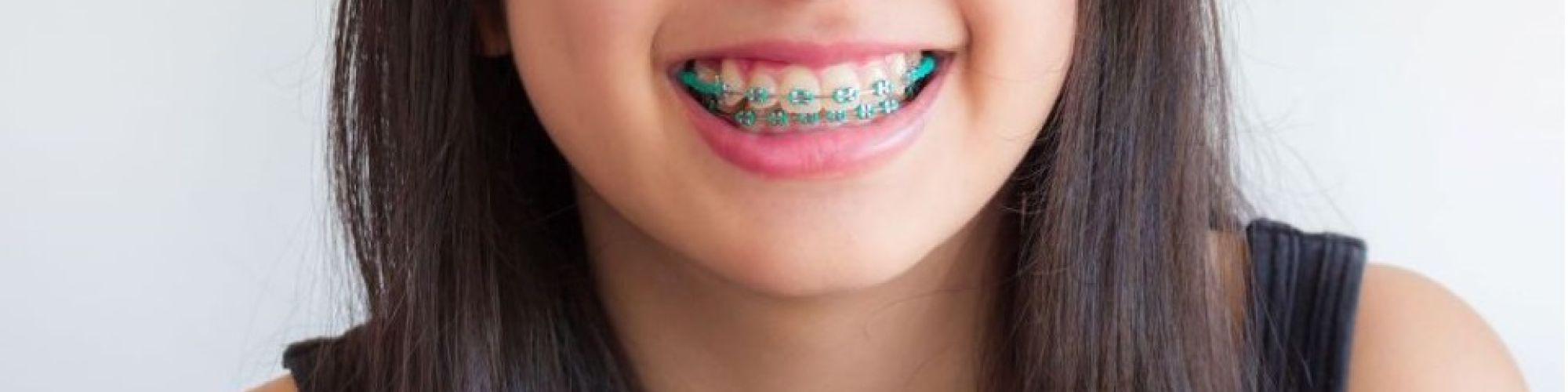 Centra Dental - When Can Your Child Get South Houston Braces?