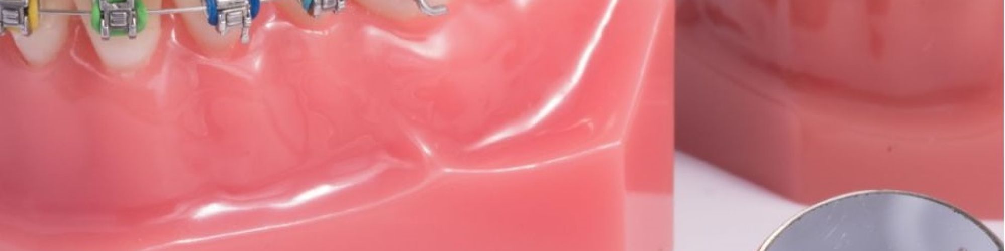 Centra Dental - Which Houston Braces Are Right for You?