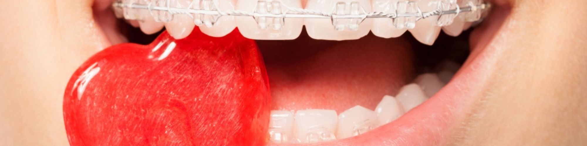 Centra Dental - How Your Child Can Take Extra Care of Their Houston Braces This Month