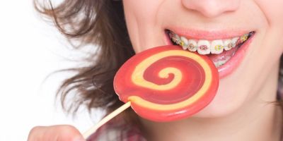 Centra Dental - Avoid Sticky Candy If Your Child Wears Houston Braces