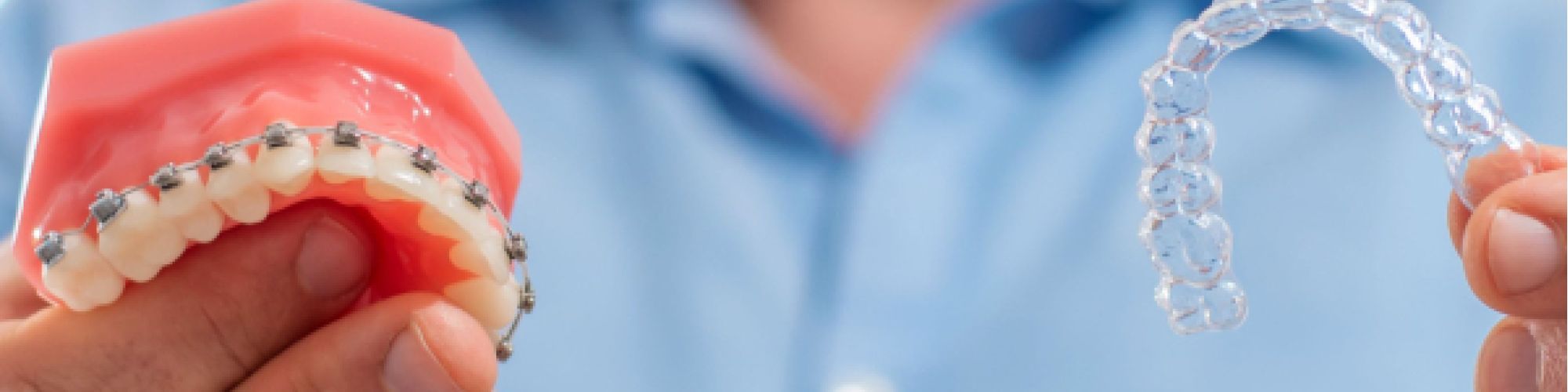 Centra Dental - How to Choose the Right Type of South Houston Braces