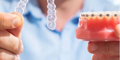 Centra Dental - South Houston Invisalign vs Braces: Which Is More Effective?
