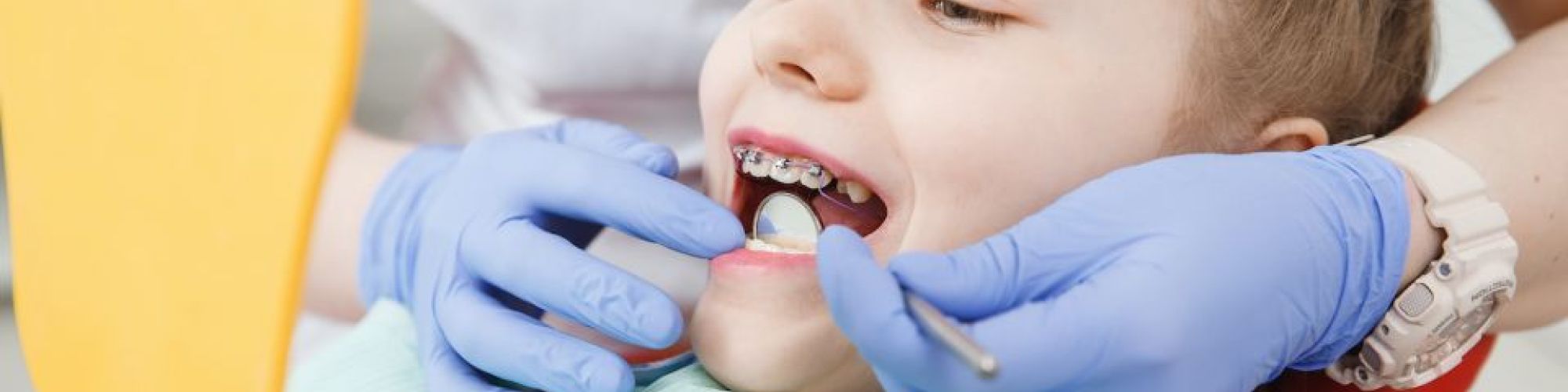 Centra Dental - How Old Does My Child Need to be in Order to Get Houston Braces