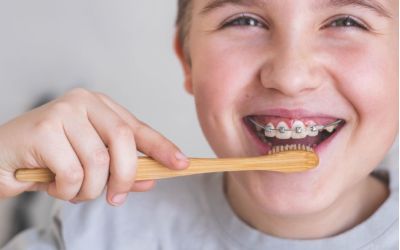 Centra Dental - How to Care for Your South Houston Dental Braces