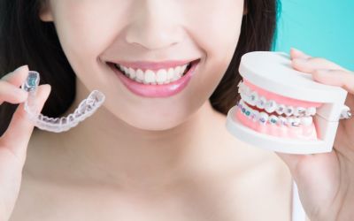Centra Dental - Are Metal Houston Braces Better Than Invisalign Clear Aligners?
