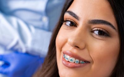 Centra Dental - How to Keep Your South Houston Braces from Breaking