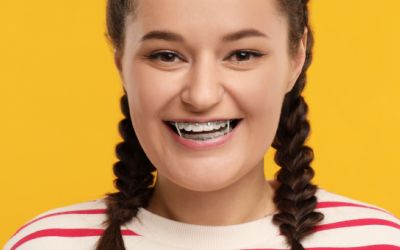 Centra Dental - The Importance of Wearing Your Elastics with Houston Braces