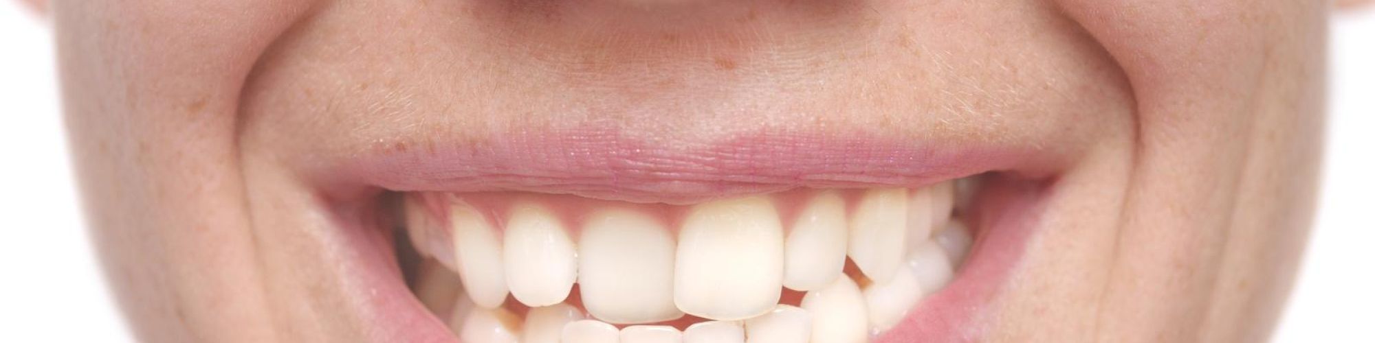 Centra Dental - Why You May Need Braces