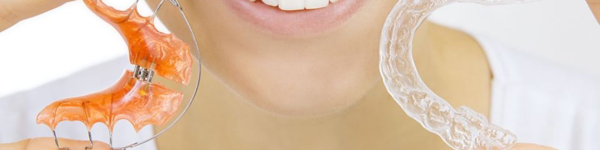 Centra Dental - Do You Need To Clean Your Orthodontic Retainers?