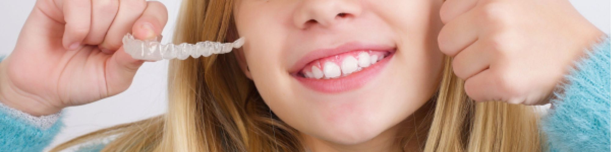 Centra Dental - The Benefits of Starting South Houston Braces Treatment Early