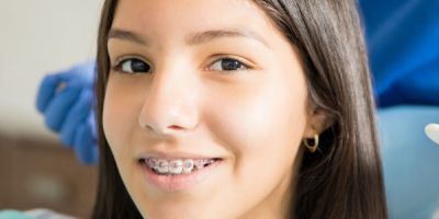 Centra Dental - Living with South Houston Braces: What to Expect in the First Week