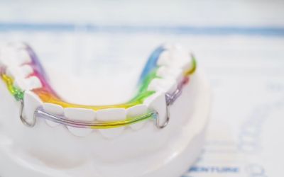 Centra Dental - Pros and Cons of Traditional Orthodontic Retainers After Houston Braces