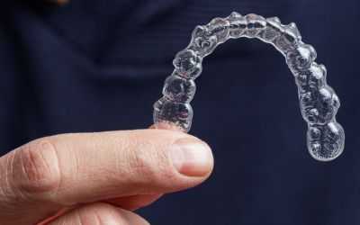 Centra Dental - South Houston Invisalign for Teens: Advantages and Tips for Successful Treatment