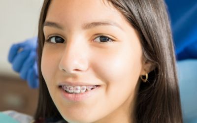 Centra Dental - Living with South Houston Braces: What to Expect in the First Week