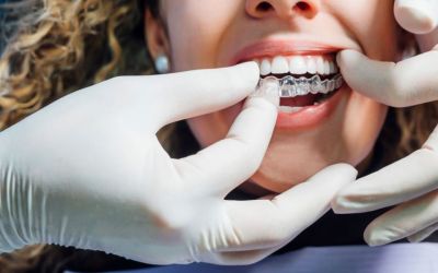 Centra Dental - South Houston Invisalign for Adults