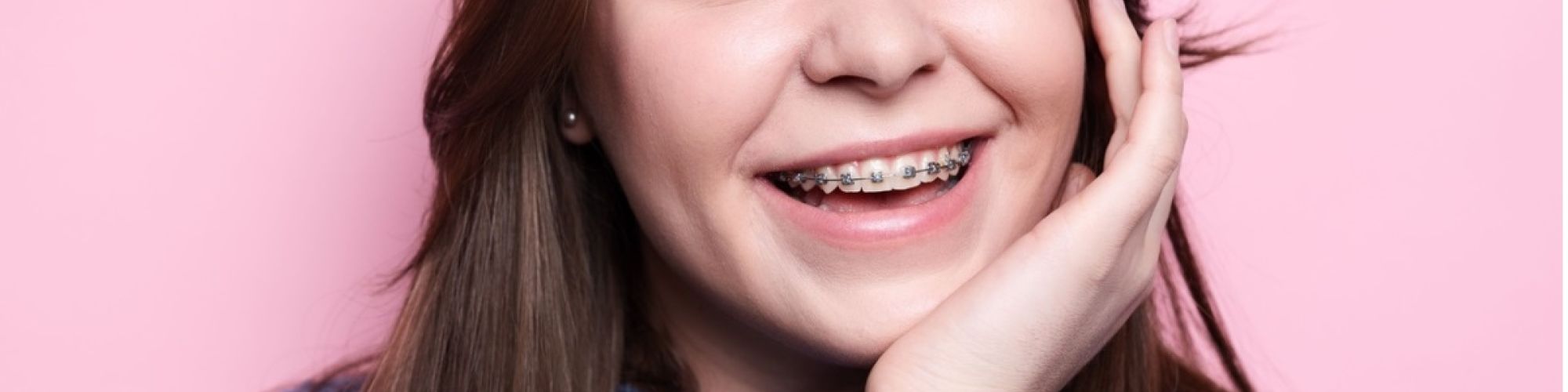 Centra Dental - How to Maximize the Effectiveness of Your Metal Houston Braces Treatment