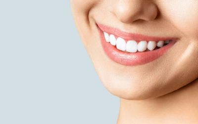 Centra Dental - Properly Wearing Your Retainers After Houston Braces
