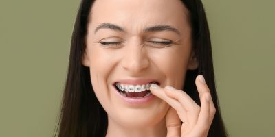 Centra Dental - How to Deal With South Houston Braces Pain