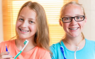 Centra Dental - Houston Braces For The Summer
