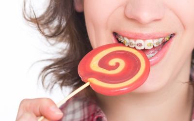 Centra Dental - Avoid Sticky Candy If Your Child Wears Houston Braces