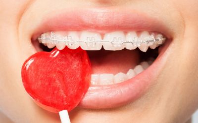 Centra Dental - How Your Child Can Take Extra Care of Their Houston Braces This Month