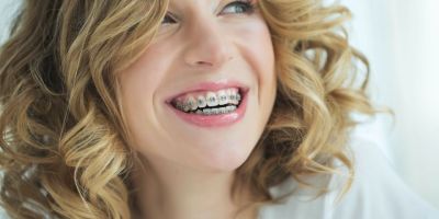 Centra Dental - When Are Metal Houston Braces Recommended