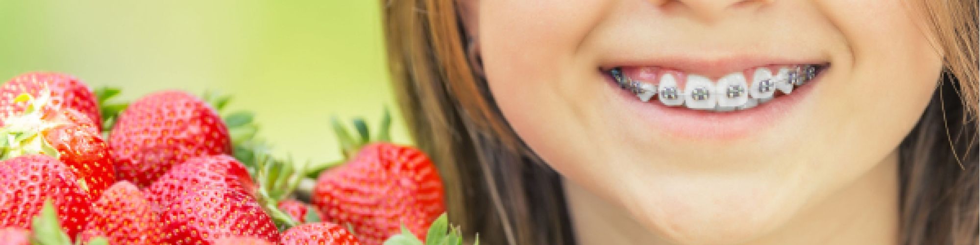 Centra Dental - South Houston Braces-friendly Diet: What You Can and Can't Eat
