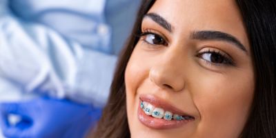 Centra Dental - How to Keep Your South Houston Braces from Breaking