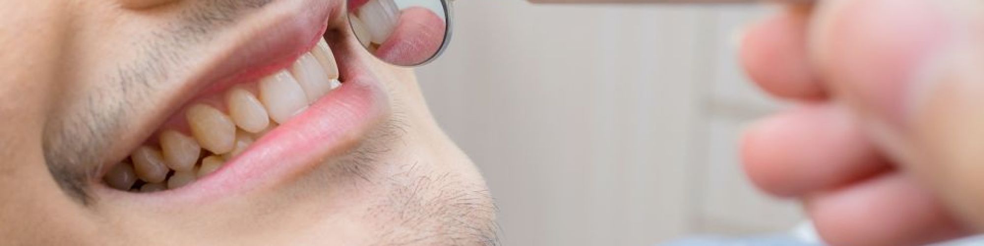 Centra Dental - All You Need to Know About Dental Benefits at Centra Dental in South Houston