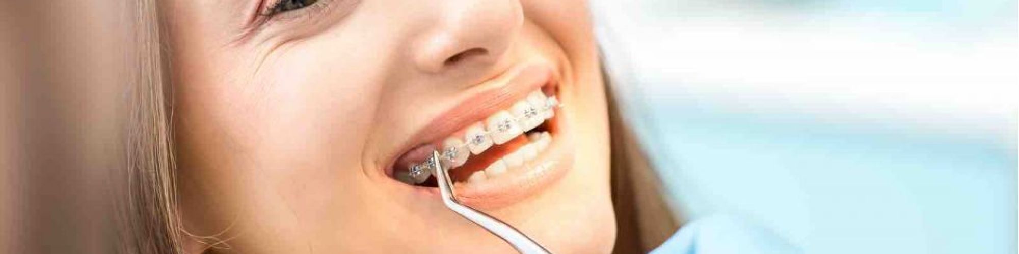 Centra Dental - Houston Braces for Kids and Adults